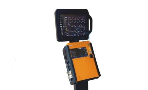 Portable ICU Ventilator - Image 3