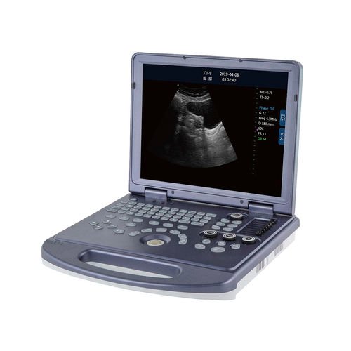 Full Digital Ultrasonic Diagnostic System