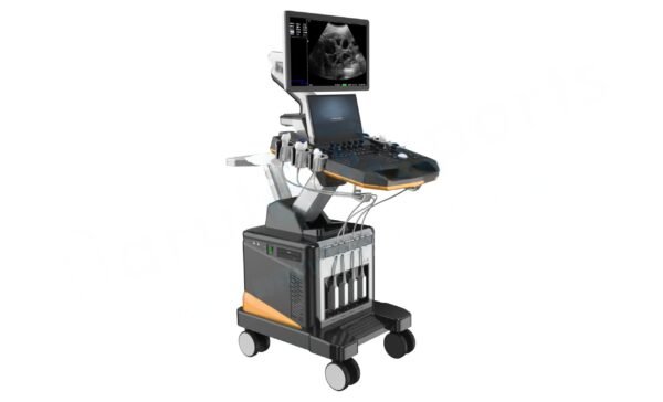 3D and 4D Cardiac Ultrasound Scan Machine - Image 2