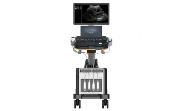 3D and 4D Cardiac Ultrasound Scan Machine - Image 3