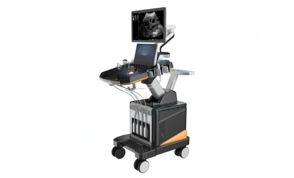 3D and 4D Cardiac Ultrasound Scan Machine - Image 5